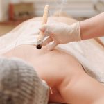 A moxibustion therapy session with acupuncture, showcasing traditional Chinese medicine techniques.