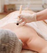 A moxibustion therapy session with acupuncture, showcasing traditional Chinese medicine techniques.